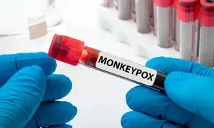 South Africa reports three new cases of monkeypox