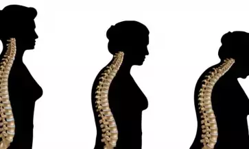 Celltrions bone disease biosimilars get approval in US Celltrions bone disease biosimilars get approval in US