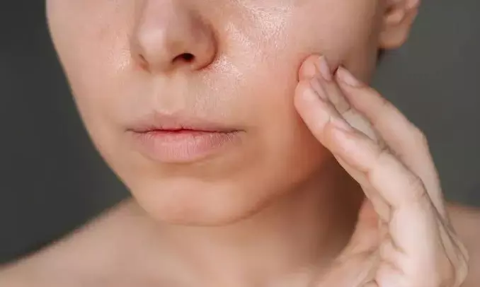 Are you troubled by oily skin? Follow these easy tips for glowing and healthy skin