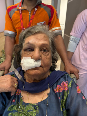 Denied wheelchair 82-year-old woman lands in ICU, Air India reacts