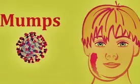 TN issues high alert as mumps spread among schoolchildren in Coimbatore