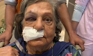 Denied wheelchair 82-year-old woman lands in ICU, Air India reacts