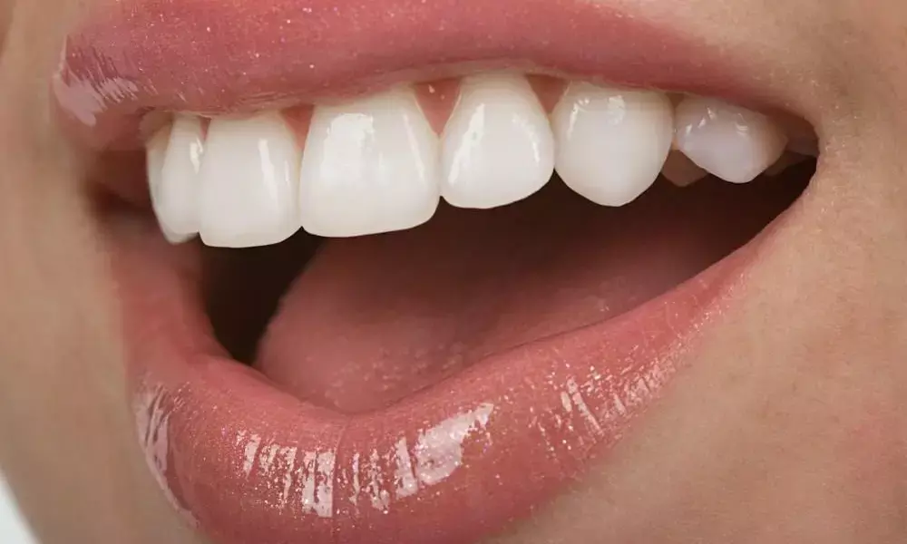 Dental care: Troubled with yellow and dirty teeth? Follow these home remedies to get pearly white teeth