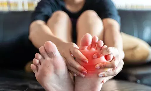 Why does uric acid increase rapidly in women? Know these are the main reasons