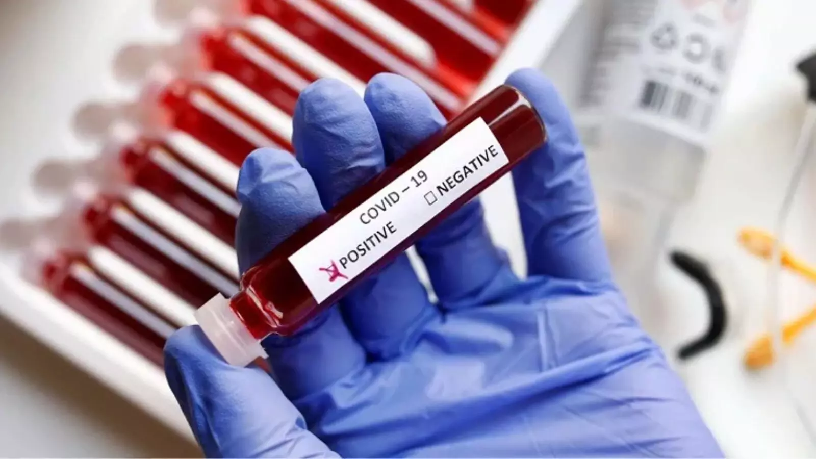 Chandigarh Reports First COVID Death in Latest Wave as Virus Resurfaces Across India