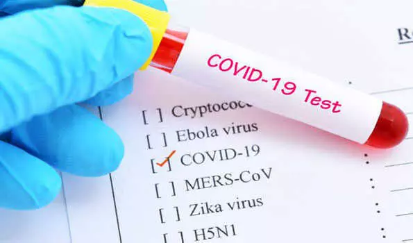 Chhattisgarh Reports 12 New COVID-19 Cases Across Seven Districts, 15 Patients Recover Chhattisgarh Reports 12 New COVID-19 Cases Across Seven Districts, 15 Patients Recover