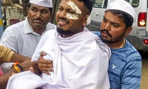 Sole Survivor of Air India Plane Crash Discharged; Carries Brother’s Body for Final Rites