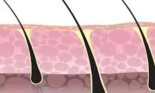 PP405: Promising New Hair Loss Treatment Could Transform Care in India, Pending Trials