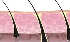 PP405: Promising New Hair Loss Treatment Could Transform Care in India, Pending Trials