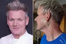 Gordon Ramsay Undergoes Surgery for Skin Cancer, Warns Fans: ‘Don’t Forget Your Sunscreen’