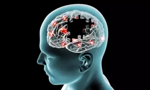 The Oral-Inflammation Connection: Unraveling the Link Between Periodontitis and Multiple Sclerosis Severity