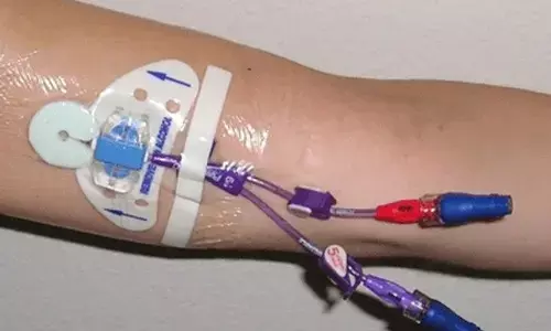 From Kolkata to Rajasthan, Quality Failures of Critical Care Devices Raise National Patient Safety Questions From Kolkata to Rajasthan, Quality Failures of Critical Care Devices Raise National Patient Safety Questions