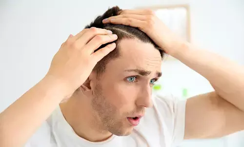 Early Hair Loss and Premature Greying? Homeopathy May Have Answers