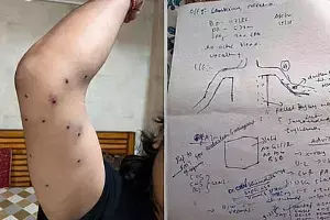 10 Protesters Hurt By Pellets At Jantar Mantar, RTI Shows 10 Protesters Hurt By Pellets At Jantar Mantar, RTI Shows