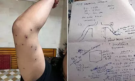 10 Protesters Hurt By Pellets At Jantar Mantar, RTI Shows 10 Protesters Hurt By Pellets At Jantar Mantar, RTI Shows