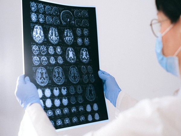 Alzheimers disease can be diagnosed with single brain scan: Research