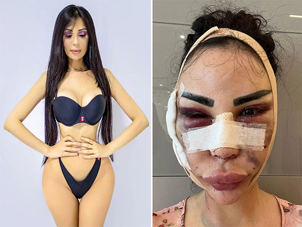 Woman spent $600K to be Kim Kardashian, now paying $120K to detransition