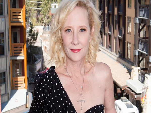 Anne Heche of Another World passes away at 53